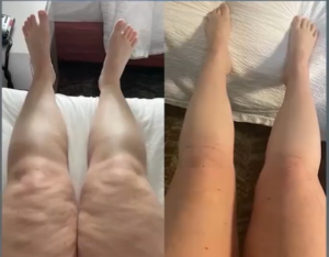 Leags Ankles Feet shrink 3